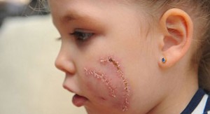 k3k3-Alaa-29122013-1